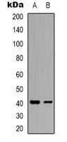 hNRNP C Rabbit Polyclonal Antibody