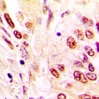 hNRNP C Rabbit Polyclonal Antibody
