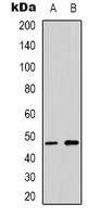 p53 Rabbit Polyclonal Antibody