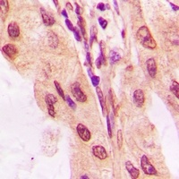 p53 Rabbit Polyclonal Antibody