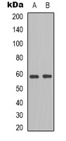 BLK Rabbit Polyclonal Antibody