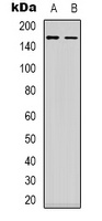 MEKK1 Rabbit Polyclonal Antibody
