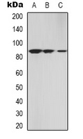 cGK 2 Rabbit Polyclonal Antibody