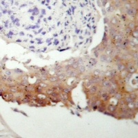 cGK 2 Rabbit Polyclonal Antibody