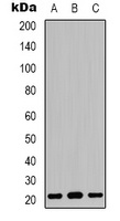 Claudin 3 Rabbit Polyclonal Antibody