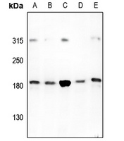 HER2 Rabbit Polyclonal Antibody