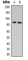 GRK3 Rabbit Polyclonal Antibody