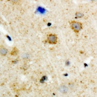GRK3 Rabbit Polyclonal Antibody