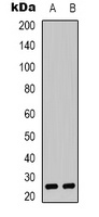 CYB561D1 Rabbit Polyclonal Antibody