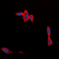 CYB561D1 Rabbit Polyclonal Antibody