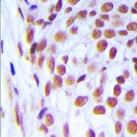 DNA Ligase 1 Rabbit Polyclonal Antibody