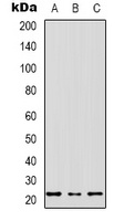 MRPS17 Rabbit Polyclonal Antibody