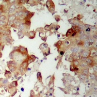 MRPS17 Rabbit Polyclonal Antibody