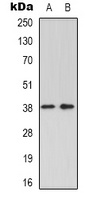 GRAP2 Rabbit Polyclonal Antibody