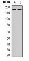 NBEAL1 Rabbit Polyclonal Antibody