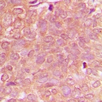 NBEAL1 Rabbit Polyclonal Antibody