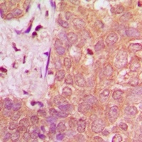 NAV1 Rabbit Polyclonal Antibody