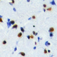 NOL8 Rabbit Polyclonal Antibody