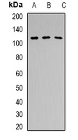 PRPF6 Rabbit Polyclonal Antibody