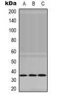 NEK7 Rabbit Polyclonal Antibody