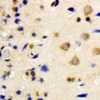 NEK7 Rabbit Polyclonal Antibody