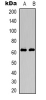 HNF1 beta Rabbit Polyclonal Antibody