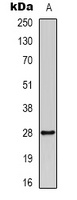 14-3-3-pan (Acetyl-K51/49) Rabbit Polyclonal Antibody
