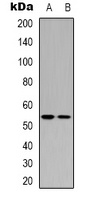 p53 Rabbit Polyclonal Antibody