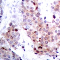 p53 Rabbit Polyclonal Antibody