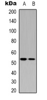 p53 (Acetyl-K370) Rabbit Polyclonal Antibody