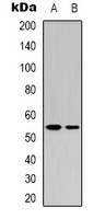 p53 Rabbit Polyclonal Antibody