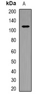 PARP1 Rabbit Polyclonal Antibody