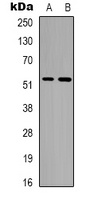 Alpha-tubulin (Acetyl-K352) Rabbit Polyclonal Antibody