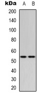 p53 (MonoMethyl-K370) Rabbit Polyclonal Antibody
