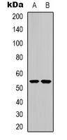 CHRNA9 Rabbit Polyclonal Antibody