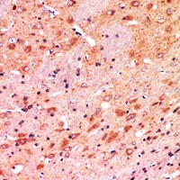 CALB1 Antibody