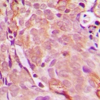 EDA Rabbit Polyclonal Antibody
