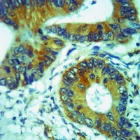 CCR6 Antibody