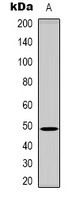 CD158e Rabbit Polyclonal Antibody