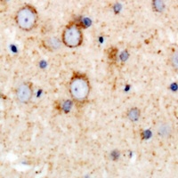 CD158e Rabbit Polyclonal Antibody