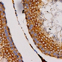 CCL27 Antibody
