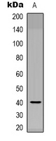 NODAL Rabbit Polyclonal Antibody