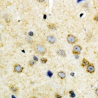 NODAL Rabbit Polyclonal Antibody