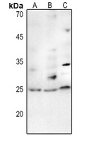 TP53INP2 Rabbit Polyclonal Antibody