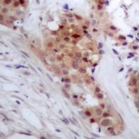 TP53INP2 Rabbit Polyclonal Antibody