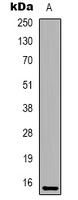 IFITM2 Rabbit Polyclonal Antibody