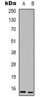 BATF3 Rabbit Polyclonal Antibody