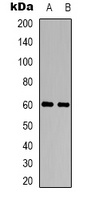 CHRM5 Rabbit Polyclonal Antibody