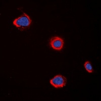 CHRM5 Rabbit Polyclonal Antibody