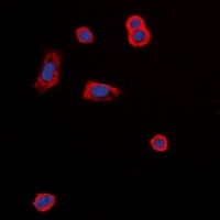 MC5 Receptor Rabbit Polyclonal Antibody